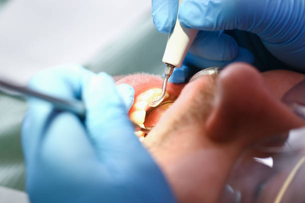 Tooth Infection Emergency Dentist in MA